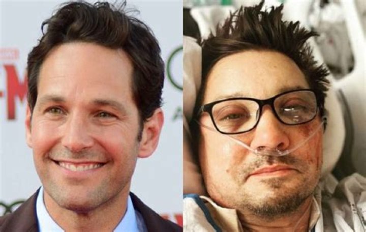 What Is Wrong With Paul Rudd Teeth? Health Update 2023 ·